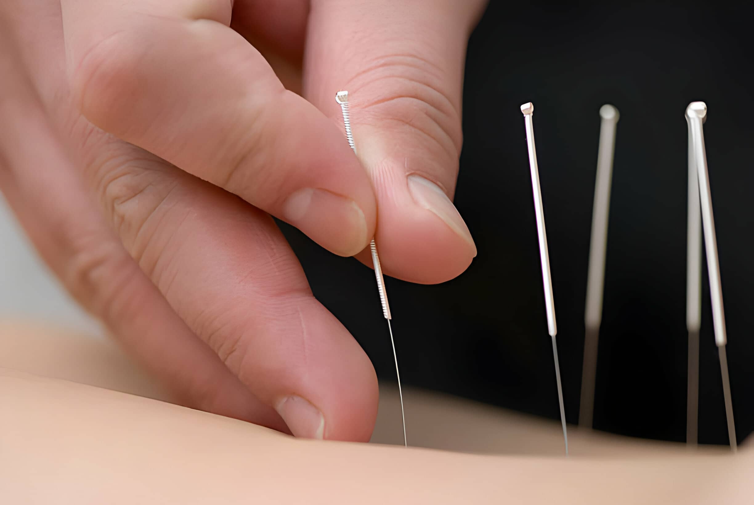 Nutrition & Acupuncture Wellness Center
