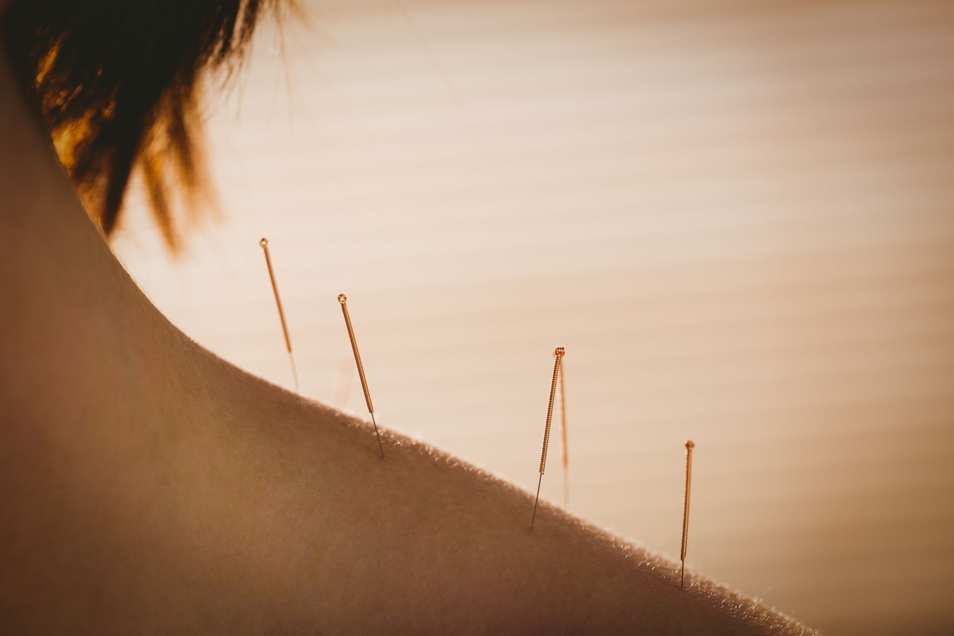 Nutrition & Acupuncture Wellness Center