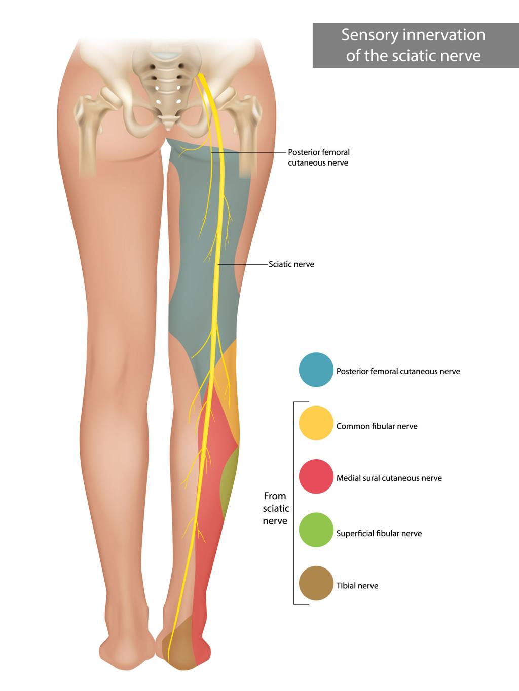 Anatomy diagram showing sciatic nerve pathway and pain distribution
